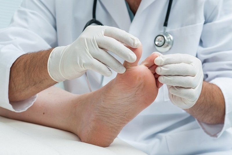 Рекомендации для профилактики грибка ног
