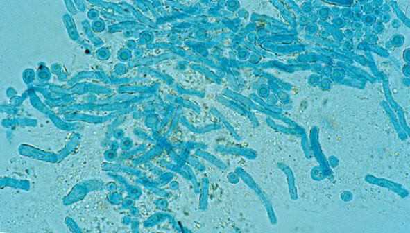 грибок Malassezia под микроскопом 