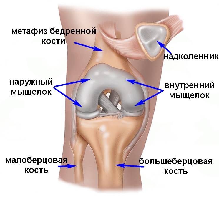 Перелом мыщелка коленного сустава фото