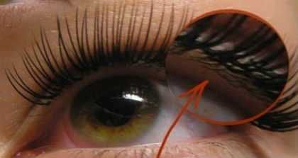 Почему болят глаза после наращивания ресниц