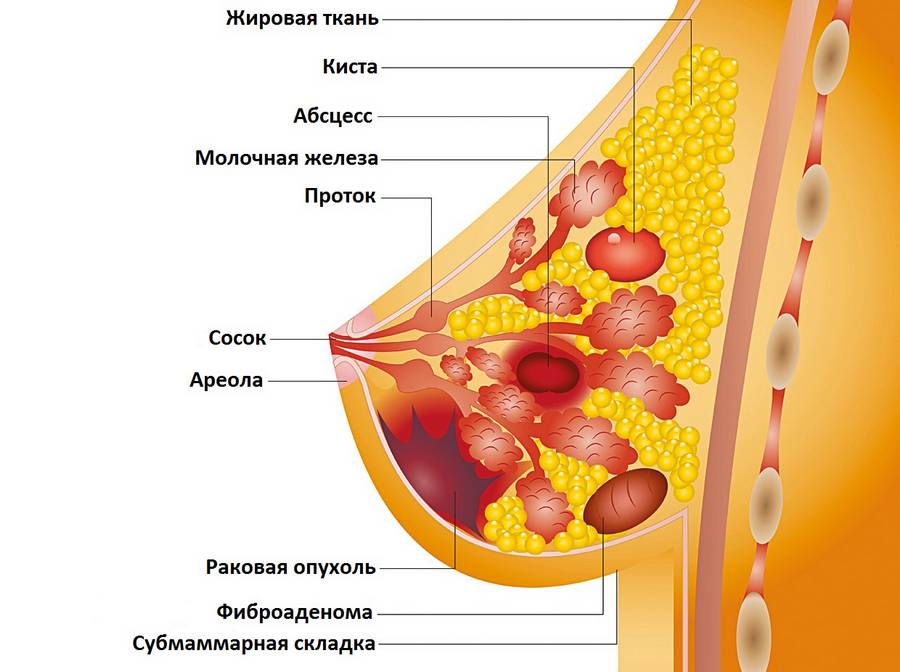виды образований в груди