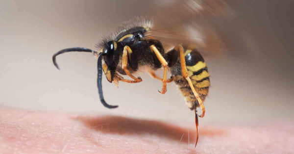 укус пчелы 