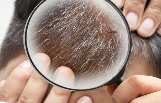 Причины появления седых волос 