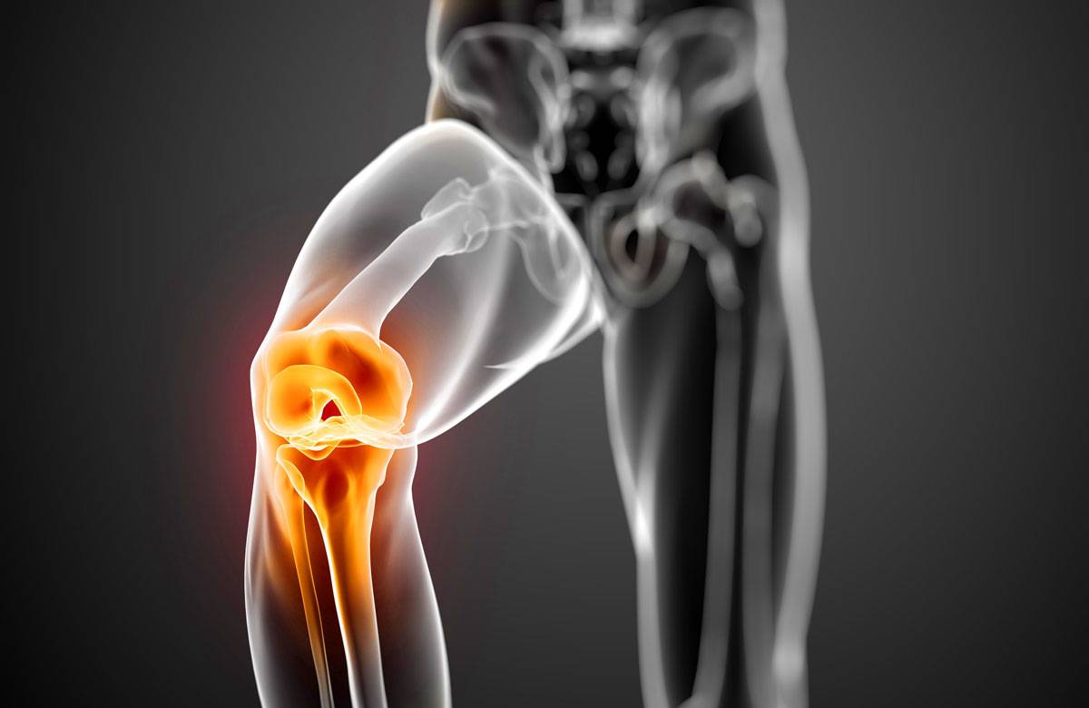 Болезнь коленного сустава 