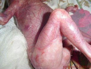  генитального герпеса во время беременности